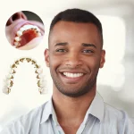 6 Benefits Of Getting Dental Braces